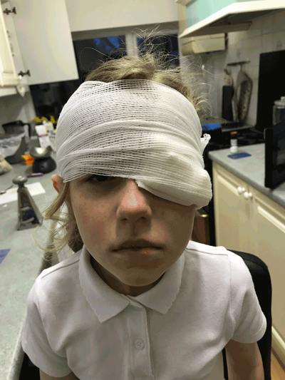 Picture of a bandaged eye